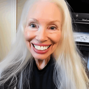 She Stole My College Fund for a Perfect Smile — Then Karma Wiped That Grin Off Her Face