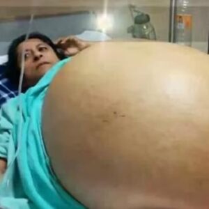 17 Year Old Girl Gives Birth To Eleven Babies, Claims She’s Never Sleep With Man