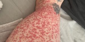 These are the consequences of sleeping in…