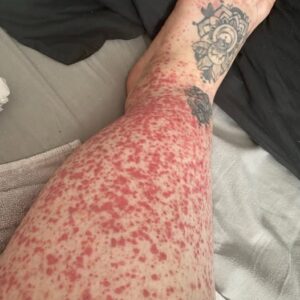 These are the consequences of sleeping in…