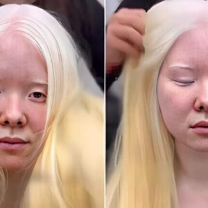 This Albino Girl Revealed Her New Brunette Look and Left Everyone Stunned…