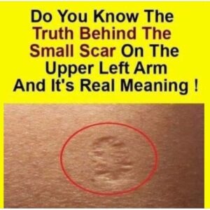 Do You Know The Real Significance Of The Small Scar On The Upper Left Arm?