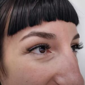 This woman got a nose job and looks unrecognizable after the surgery…