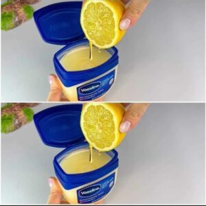 Just Mix Vaseline with Lemon and you will be shocked! Method in the first comment