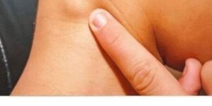 What Do Neck Lumps Mean?