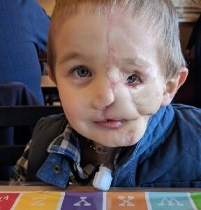 Boy, 5, survives savage attack by two dogs only to be called a ‘monster’ in public