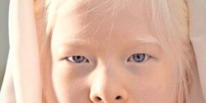 Abandoned By Parents, She Vowed To Prove Them Wrong – Today, She Models For Vogue