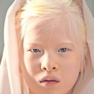 Abandoned By Parents, She Vowed To Prove Them Wrong – Today, She Models For Vogue