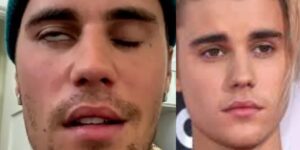 Justin Bieber admits that he tested positive for…See More