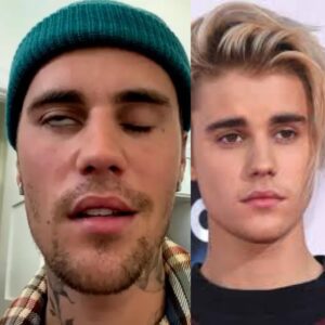 Justin Bieber admits that he tested positive for…See More