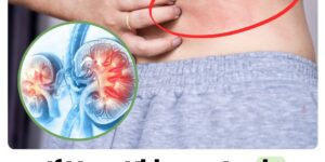 The Body Will Give You These 10 Signs if Your Kidney Is in Danger