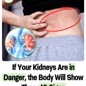 The Body Will Give You These 10 Signs if Your Kidney Is in Danger