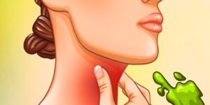 The Real Causes of Constant Phlegm and Mucus in Throat and How to Get Rid of It