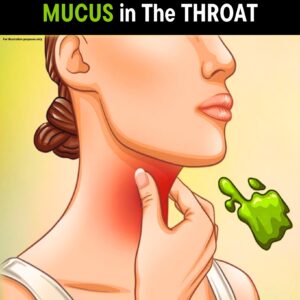 The Real Causes of Constant Phlegm and Mucus in Throat and How to Get Rid of It
