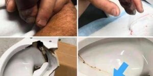 In several regions, while using their toilets, people were attacked