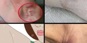 These are the signs that it’s no longer just sweat… See more