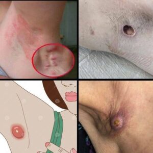 These are the signs that it’s no longer just sweat… See more