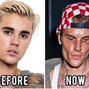 Justin Bieber sparks concern among fans over his latest post...