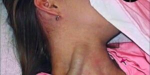 RIP Young woman d!es at the hands of her