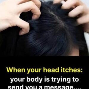 HT9. Itchy Head Won’t Go Away? Here’s What It Might Really Mean