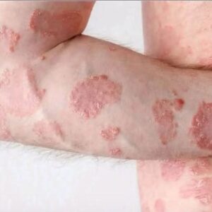 These are the consequences of sleeping with the…See more