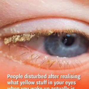 What yellow stuff in your eyes when you wake up actually is!