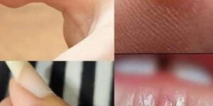 To BE VERY CAREFUL . If you get this, you are infected with …. Check the 1st comment