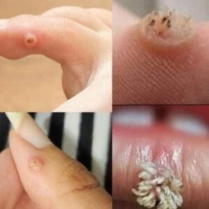 To BE VERY CAREFUL . If you get this, you are infected with …. Check the 1st comment