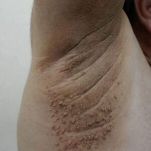 These Are The First Symptoms Of Cr…See More