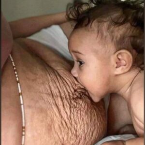 Postpartum Changes, Celebrity Moms Embracing Their Bodies
