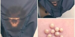 This is what it means if you find a “bleach” spot on your underwear
