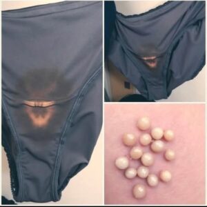 This is what it means if you find a “bleach” spot on your underwear