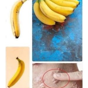 Did you know that if you eat BANANA EVERY DAY your body can…