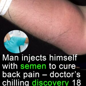Doctor issues warning after man injects himself with semen to ‘cure back pain’