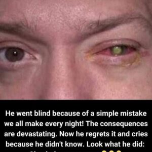 The Nightly Habit That Cost a Man His Sight: A Cautionary Tale for Contact Lens Users