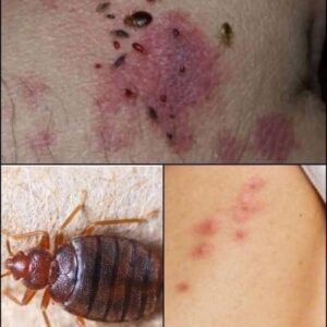 BE CAREFUL, If you spot these dots on your skin, it means you have Ca…see more