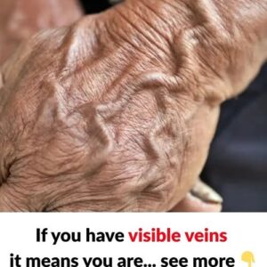 Why Veins Become More Visible with Age