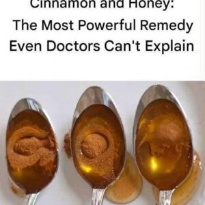 Cinnamon and Honey: The Most Powerful Remedy Even Doctors Can’t Explain