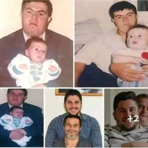 A father with Down syndrome raised his son, who is now a doctor…See more