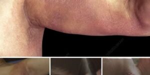HT1. There’s the first symptom of a silent but serious condition… See more