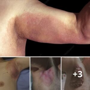 HT1. There’s the first symptom of a silent but serious condition… See more