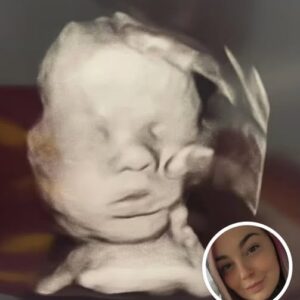 Pregnant Mom Prays For Her Baby’s Health, Stunned When She Looks Closer At Ultrasound