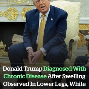 Donald Trump diagnosed