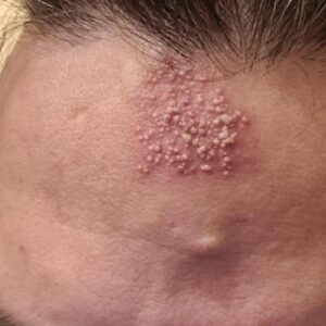These are the consequences of sleeping with…See more