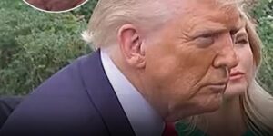 Concerning Marks On Trump’s Hand? Experts Reveal What They Really Are