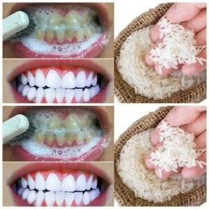The trick to whitening your teeth with rice.