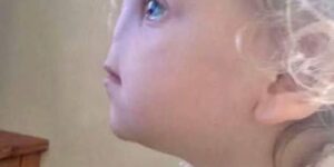 Tessa Evans’ Rare Condition: Overcoming Challenges