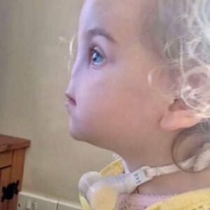 Tessa Evans’ Rare Condition: Overcoming Challenges