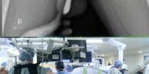Girl was hospitalized