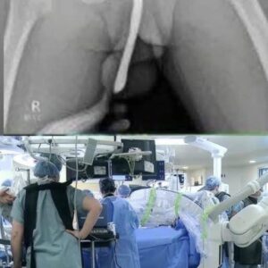Girl was hospitalized